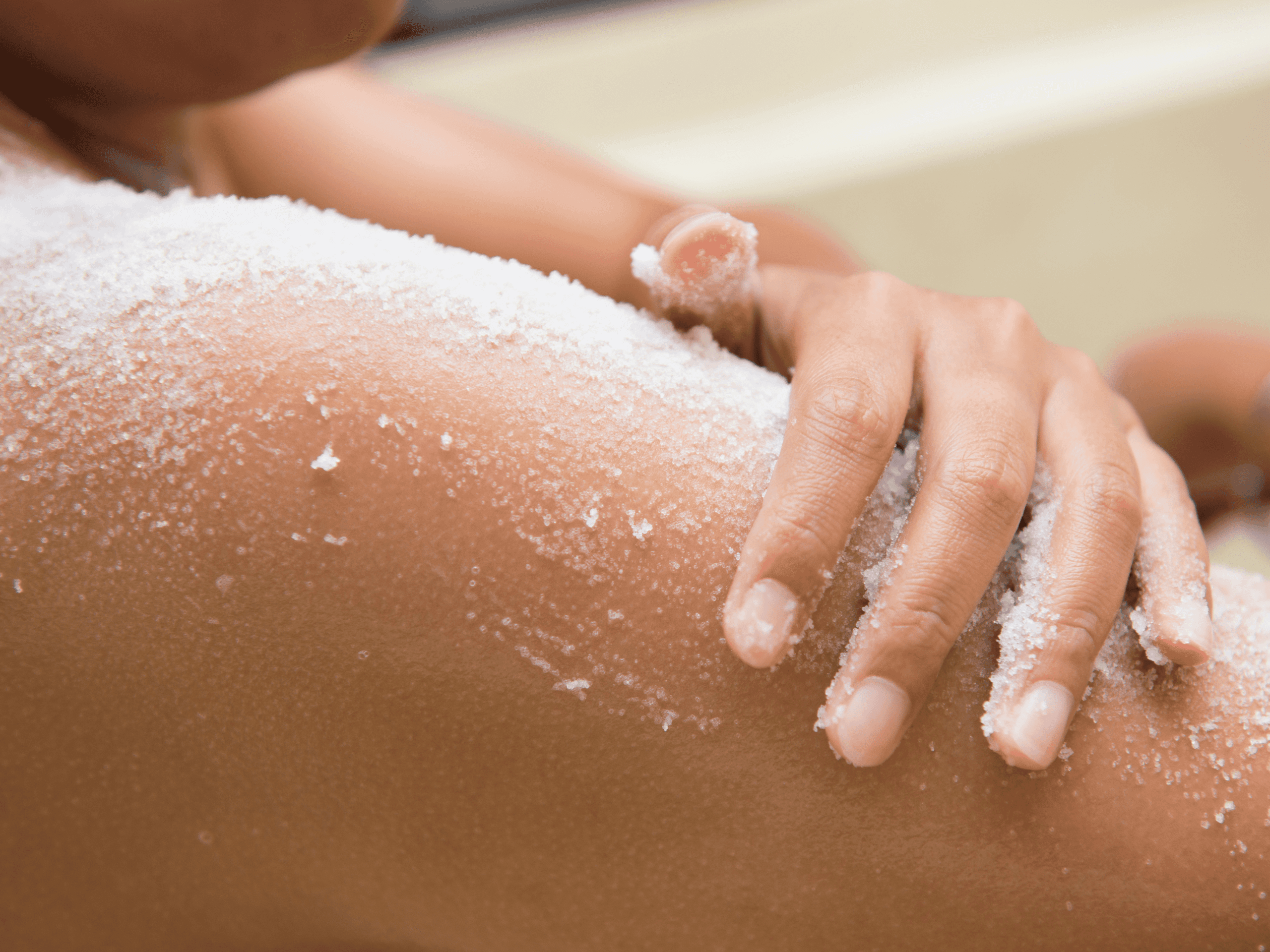 ¿Qué tratamientos estéticos puedes hacer en verano sin riesgos? Guía 2025 ☀️