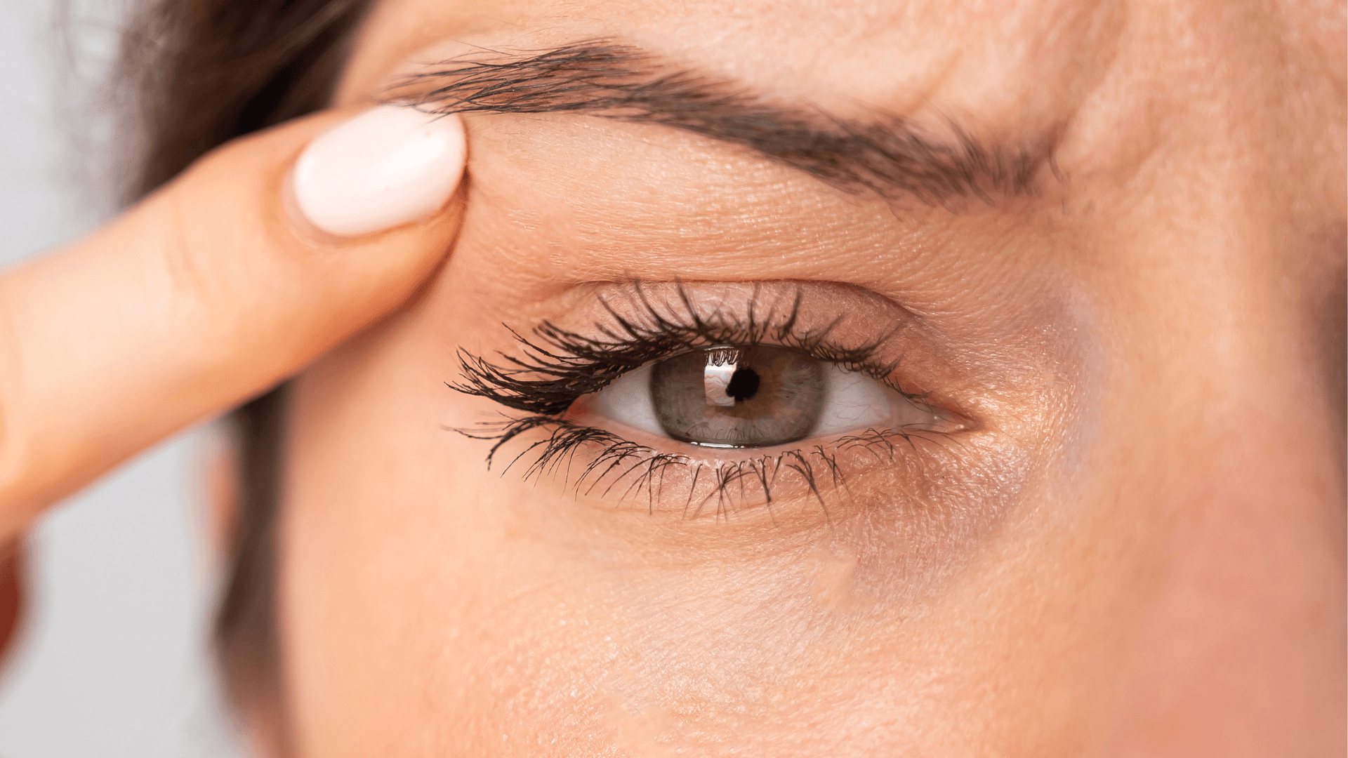 Cicatriz de blefaroplastia: Cómo cuidarla para que sea prácticamente invisible