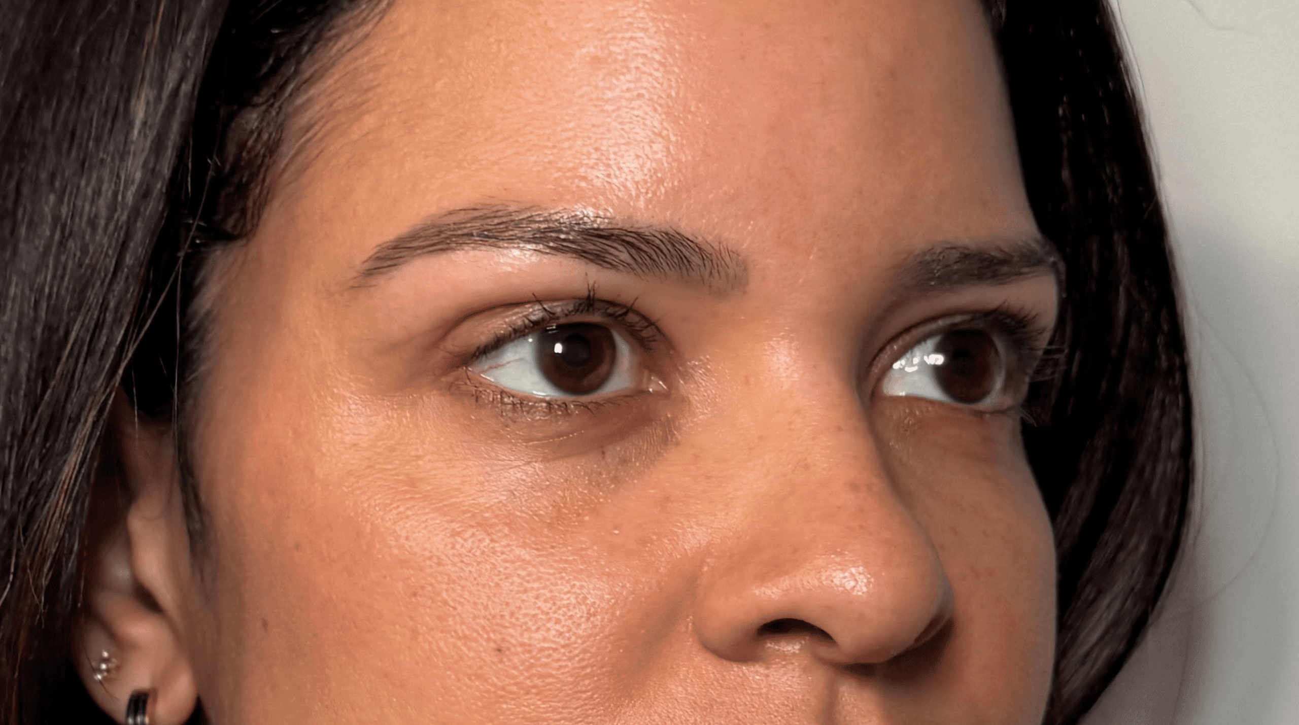 Cicatriz de blefaroplastia: cómo queda, cuánto tarda en desaparecer y cómo cuidarla